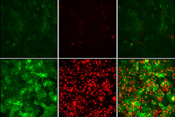 biosensores-Innoprot